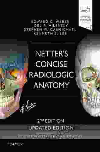 Netter S Concise Radiologic Anatomy Updated Edition E (Netter Basic Science)